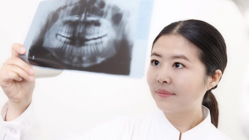 种植牙基台材质揭秘：如何选择适合自己的材料**