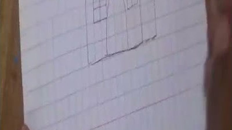 全瓷牙安装前的关键磨牙步骤揭秘